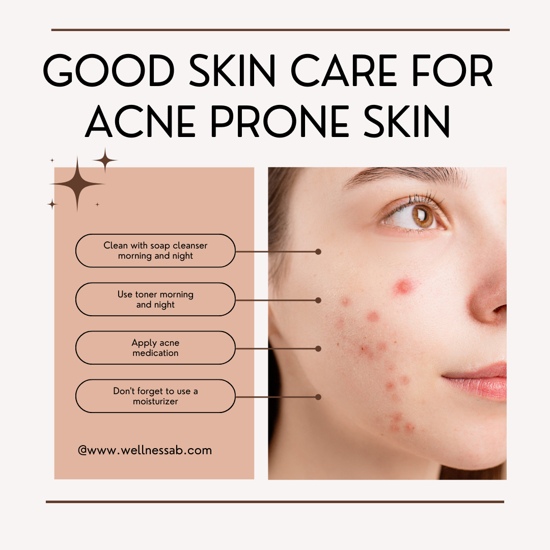 acne-prone skin