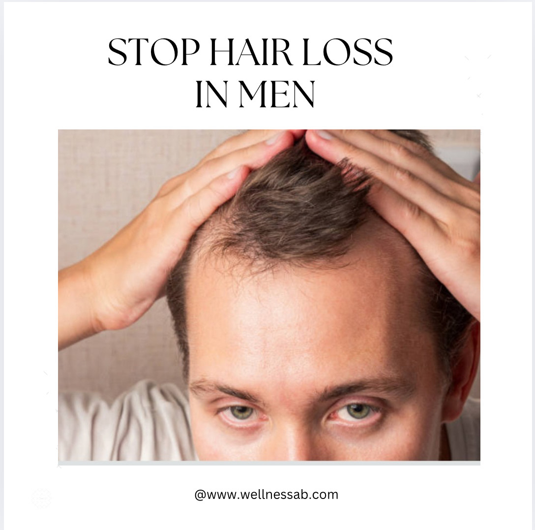 Hair Loss